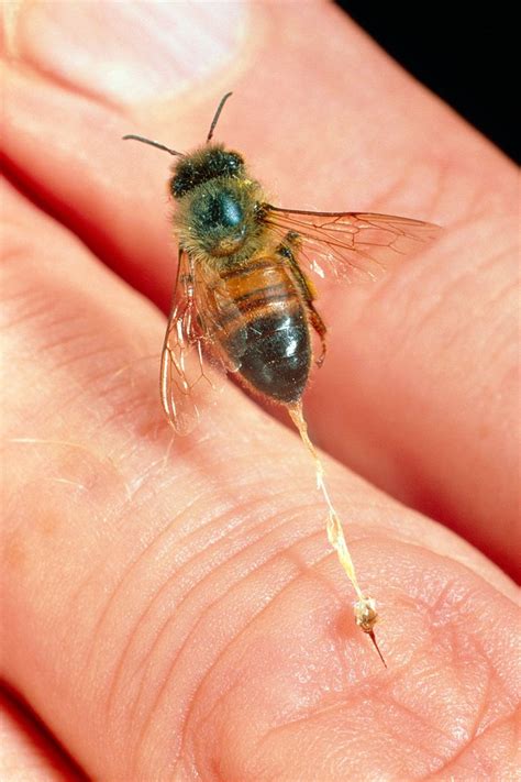 photo of bee sting